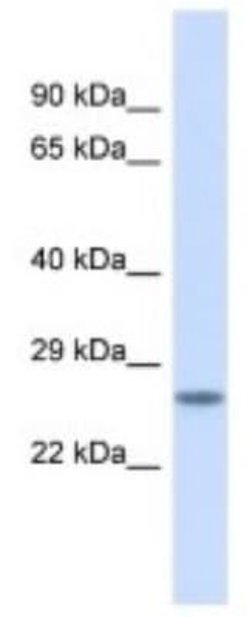 BSX Rabbit anti-Human, Polyclonal, Novus Biologicals 100 &mu;g | Buy Online | Novus Biologicals | Fisher Scientific